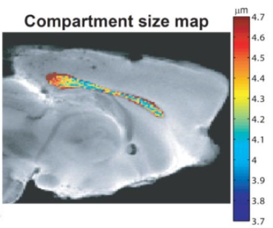 Compartment size map of a ex-vivo mouse brain masked for the corpus callosum